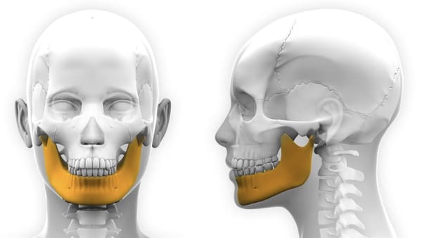 chirurgie orthognatique avant apres osteotomie mandibulaire osteotomie machoire docteur roul yvonnet chirurgien maxillo facial paris 14