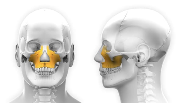 Ostéotomie maxillaire - Chirurgien maxillo-facial (Paris ...